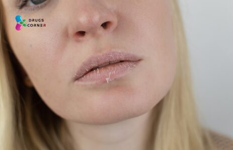 Why Your Eczema on Lips May Worsen and You Don’t Even Know